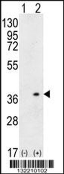 HLA-DQA1 Antibody