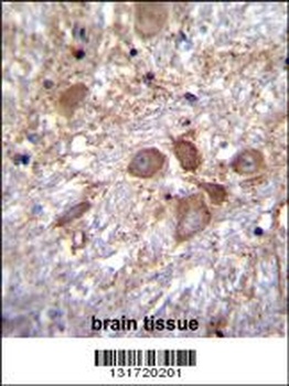 SPECC1L Antibody