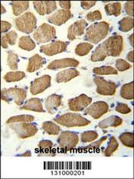 hCG_1645727 Antibody