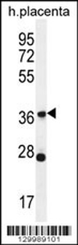 OR4L1 Antibody