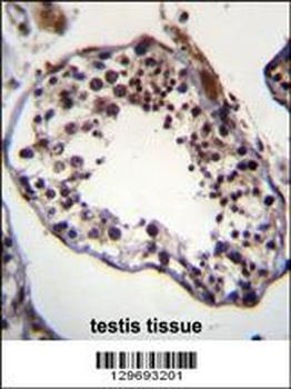 TRIM69 Antibody