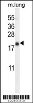 TMEM80 Antibody