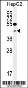 GLRX3 Antibody