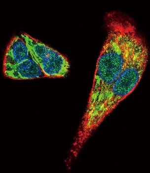 MDK Antibody