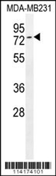 Tiparp Antibody