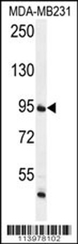 FTSJ3 Antibody