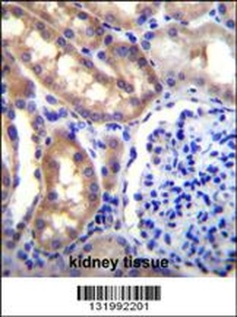 SH2D4A Antibody