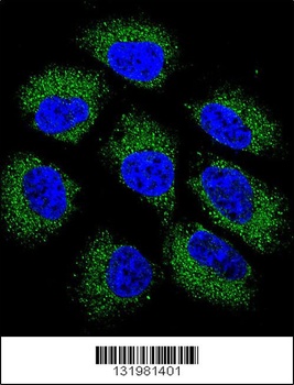 GSR Antibody