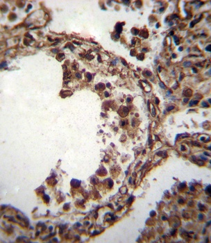 TUBA1C Antibody