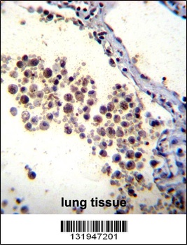 DOK3 Antibody