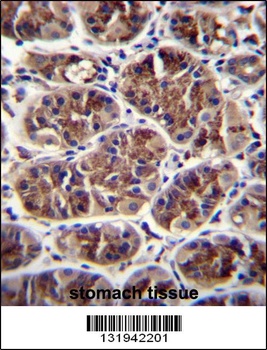 GDF5 Antibody