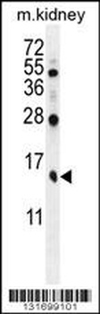 TBCA Antibody