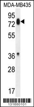 PCDHB13 Antibody