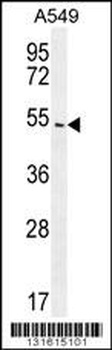 ARRB1 Antibody