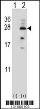 IL17B Antibody