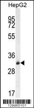 OR4K5 Antibody