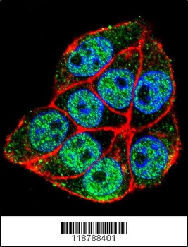 TRADD Antibody