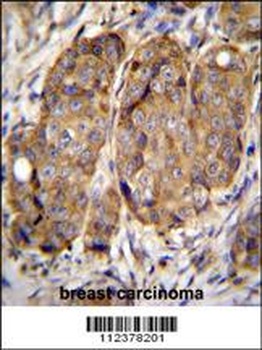 METTL2A Antibody