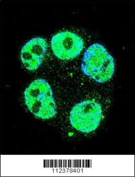 METTL2A Antibody