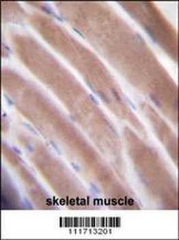 VEGF3 Antibody