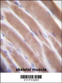 VEGFC Antibody