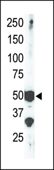 SET7 Antibody