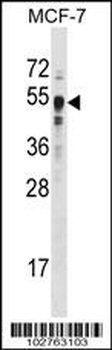 SETD7 Antibody