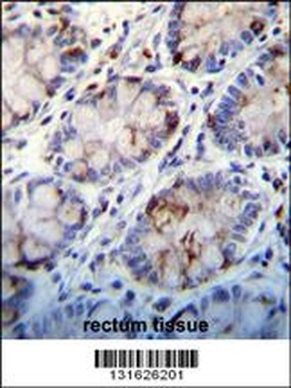 C1QC Antibody