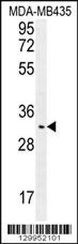 OR4K2 Antibody