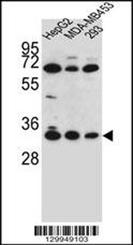 OR2T3 Antibody