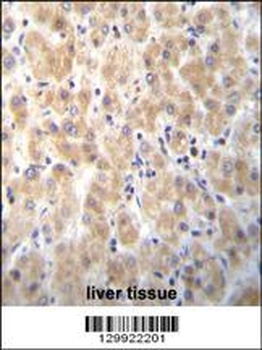 PABPN1L Antibody