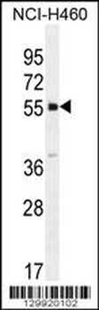 SHISA6 Antibody
