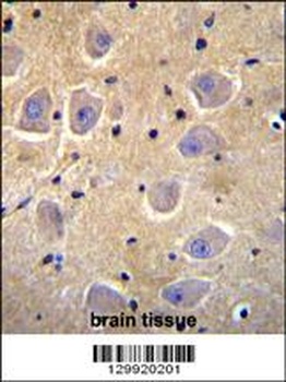 SHISA6 Antibody