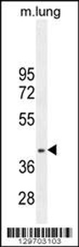 RNF215 Antibody