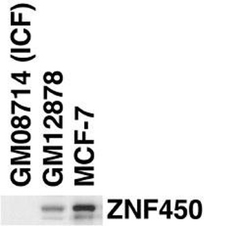 ZBTB24 Antibody