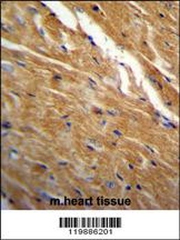 TBC1D13 Antibody