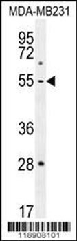 MMP1 Antibody