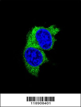 MMP1 Antibody