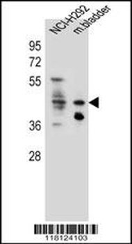 GHSR Antibody