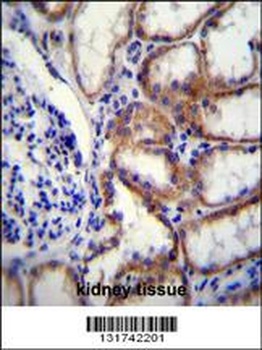 COL8A2 Antibody