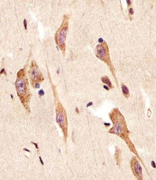 TGFBR2 Antibody