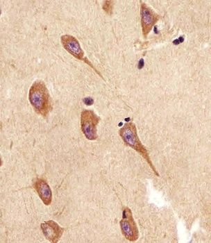 TGFBR2 Antibody