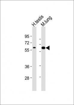 TGFBR2 Antibody