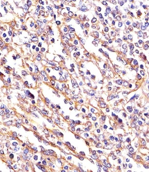 TGFBR2 Antibody