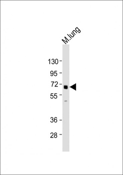 TGFBR2 Antibody