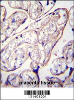 PYCR2 Antibody