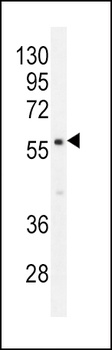 PDE1B Antibody