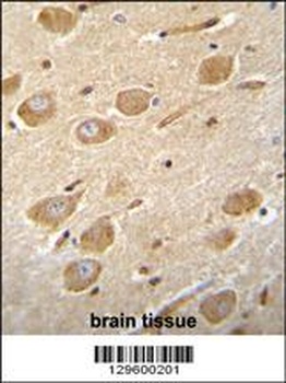 CNGA4 Antibody