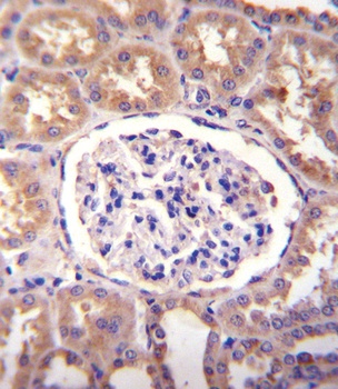 SLCO4C1 Antibody