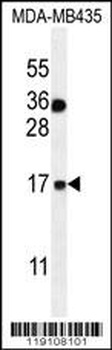 S100A1 Antibody